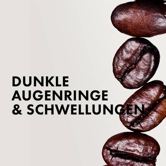 Dunkle Augenringe