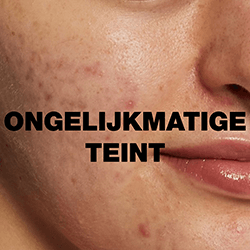 Ongelijkmatige teint