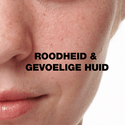 Roodheid & gevoelige huid