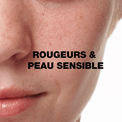 Rougeurs peau sensible
