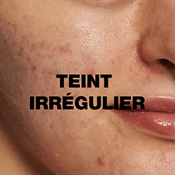 Teint irregulier