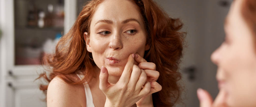 Acne - Oorzaken, symptomen en behandeling